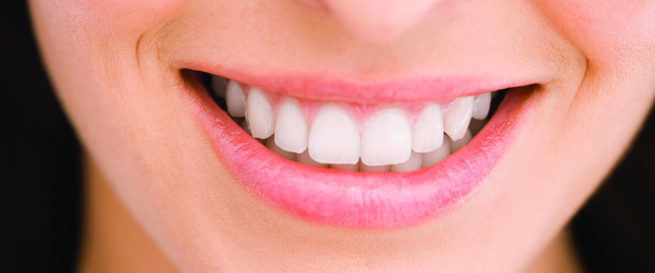 Great tooth whitening solutions